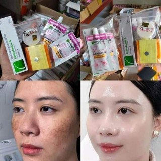 Bộ túi kem nám Thái Lan