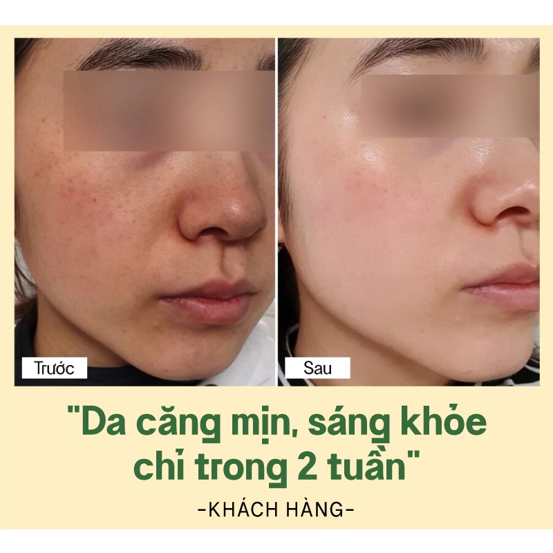 Tinh Chất Dứa Dưỡng Trắng Da Vegick Super Whitening Serum 30ml