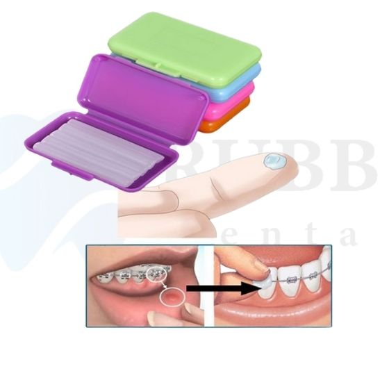 Sáp nha khoa , sáp giảm đau, không mùi cho người niềng răng chỉnh nha, chất lượng tốt, mua nhiều giá rẻ | BigBuy360 - bigbuy360.vn