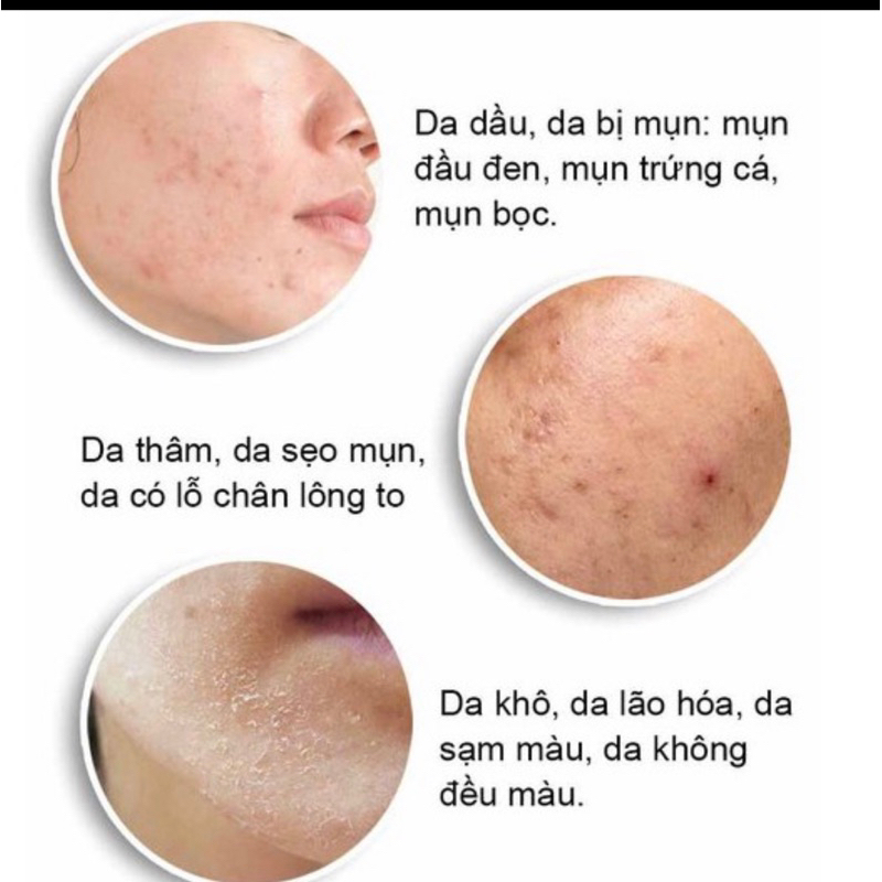 Tinh chất sáng da The ordinary Niacinamide 10% + Zinc 1%