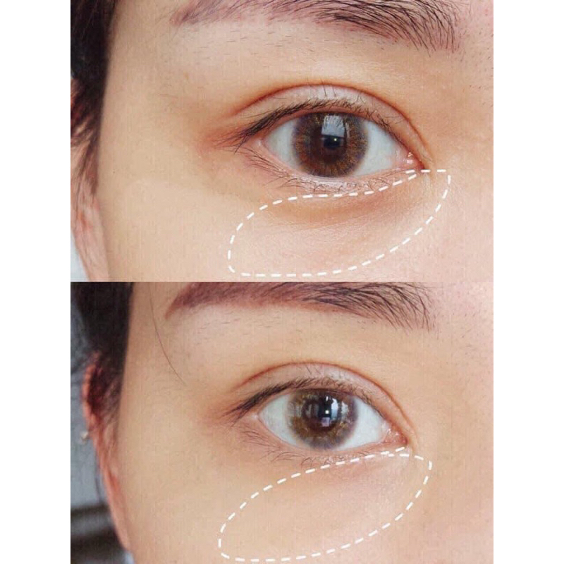 KEM MẮT CHỐNG LÃO HOÁ, NÂNG CƠ VÀ GIẢM THÂM MẮT ESTEE LAUDER ADVANCED NIGHT REPAIR EYE