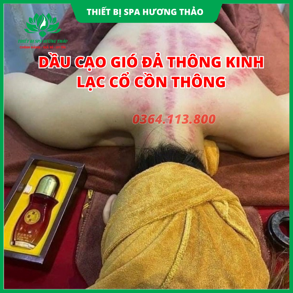 Dầu cạo gió cổn cổn thông đả thông kinh lạc, giảm đau tức thì chai 60ml