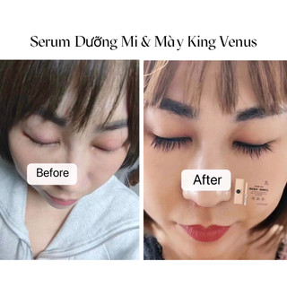 [ DATE T6/2027 ] Combo 02 Serum Dưỡng Mi và Mày King Venus: Dưỡng lông mi và lông mày đen ,rậm ,dài chắc khoẻ tự nhiên .