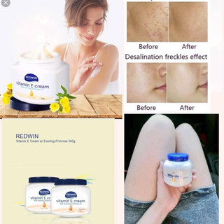 Kem Dưỡng Da Mềm Mịn Body Redwin Vitamin E Cream 300g - Giúp Da Mềm Mịn Chống Nứt Nẻ Cho Mặt Và Body