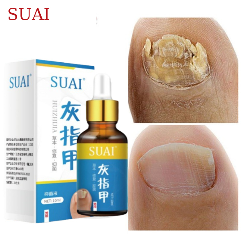 Tinh Chất SUAI Hỗ Trợ Phục Hồi Móng yếu, Giòn, Vàng, Nấm, Kém Đàn Hồi, Chống Nhiễm Khuẩn Viêm Mé Móng Giúp Móng Khỏe
