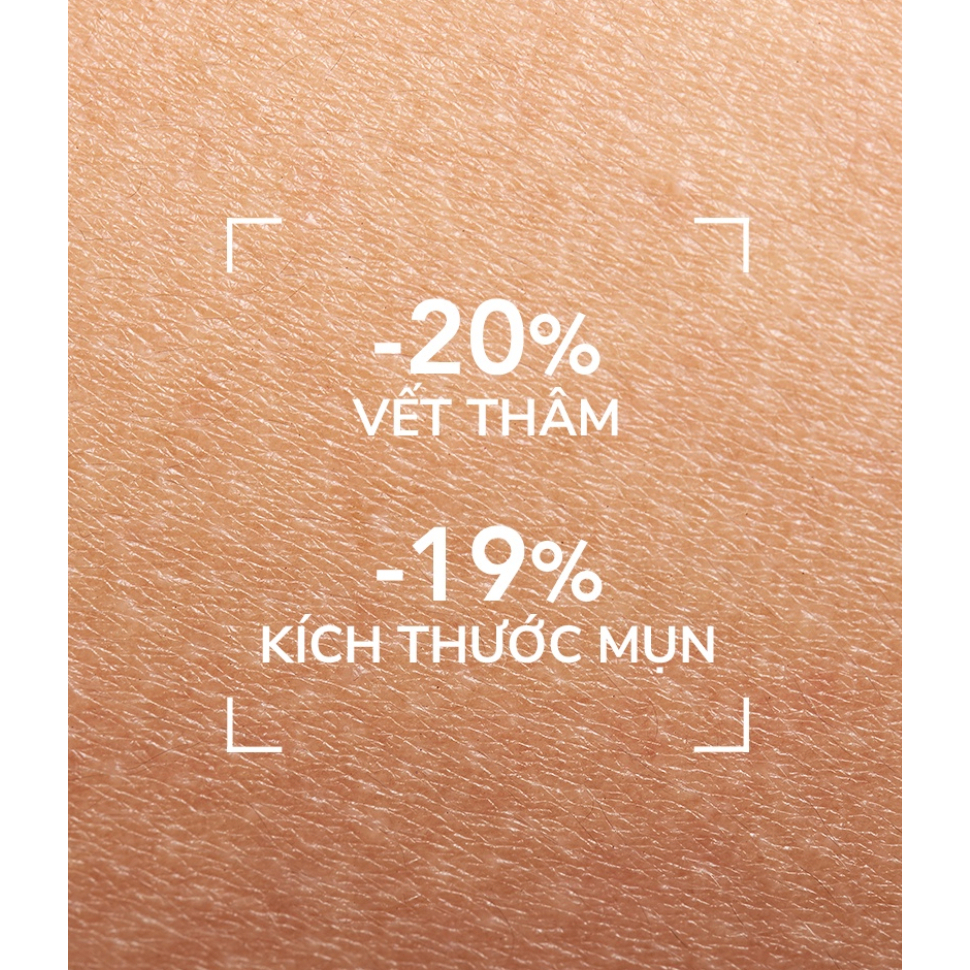 Kem dưỡng hỗ trợ giảm mụn chuyên sâu cho da mụn nhẹ đến trung bình Bioderma Sébium Kerato+ 30ml