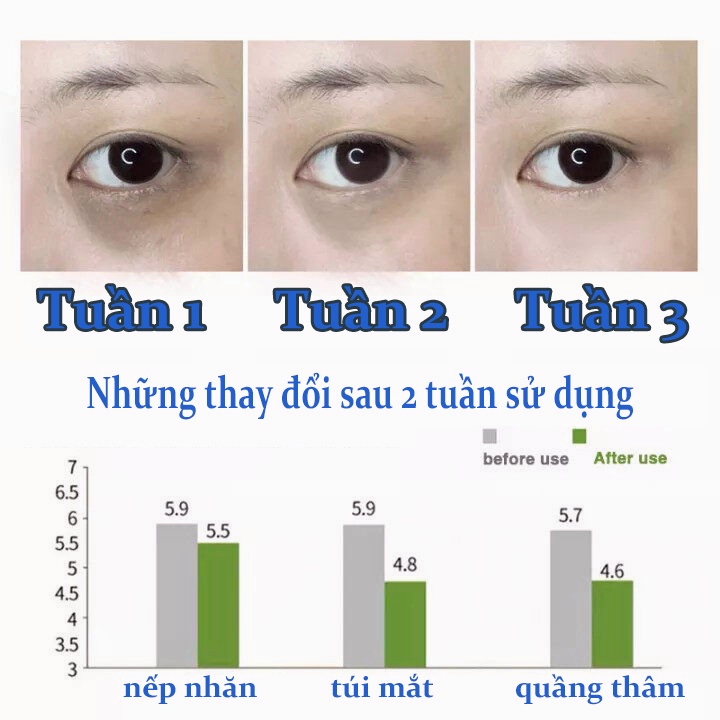 「🎯Nhà máy bán hàng trực tiếp」Kem dưỡng mắt Xóa thâm quầng mắt và tinh chất chống lão hóa mắt Kem dưỡng mắt chống nhăn
