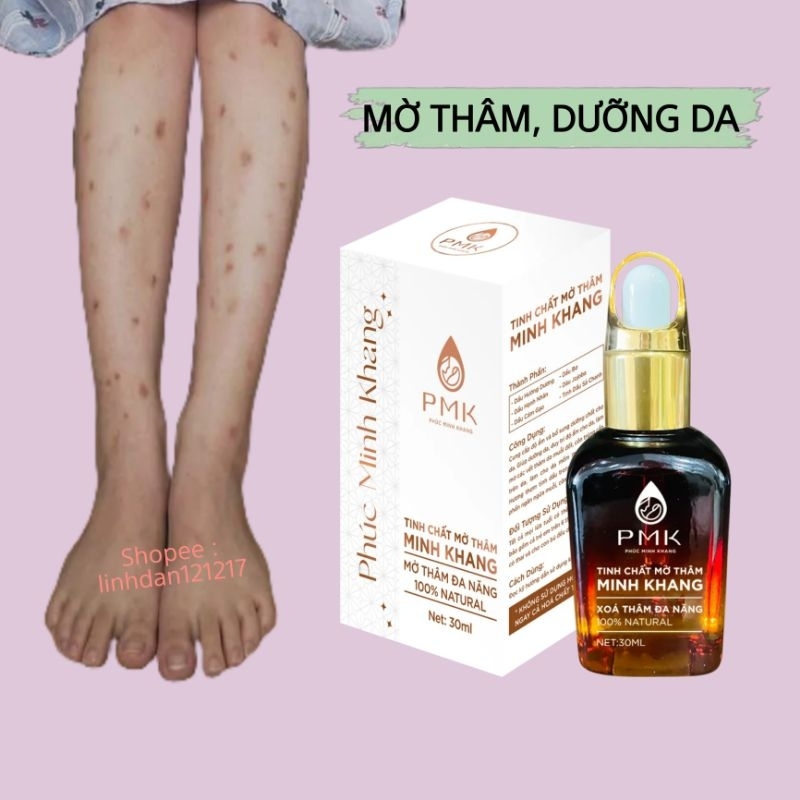 Serum xóa mờ thâm sẹo, thâm mắt,môi, nách, bikini, thâm côn trùng đốt gia truyền- tinh chất mờ thâm Minh khang