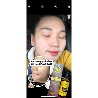 [ MCSKIN BEAUTY ] BỘ DƯỠNG NGÀY ĐÊM