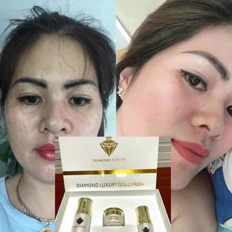 BỘ KEM NÁM DIAMOND LUXURY PRO+ dr Mishin