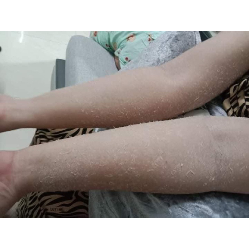 Kem body bong da hủ 100gr