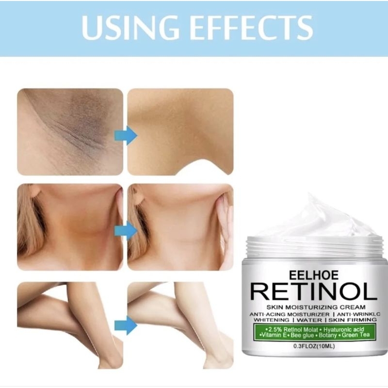 Kem Xóa Thâm Vùng Kín Bẹn, Nách, Mông,Đầu Gối,