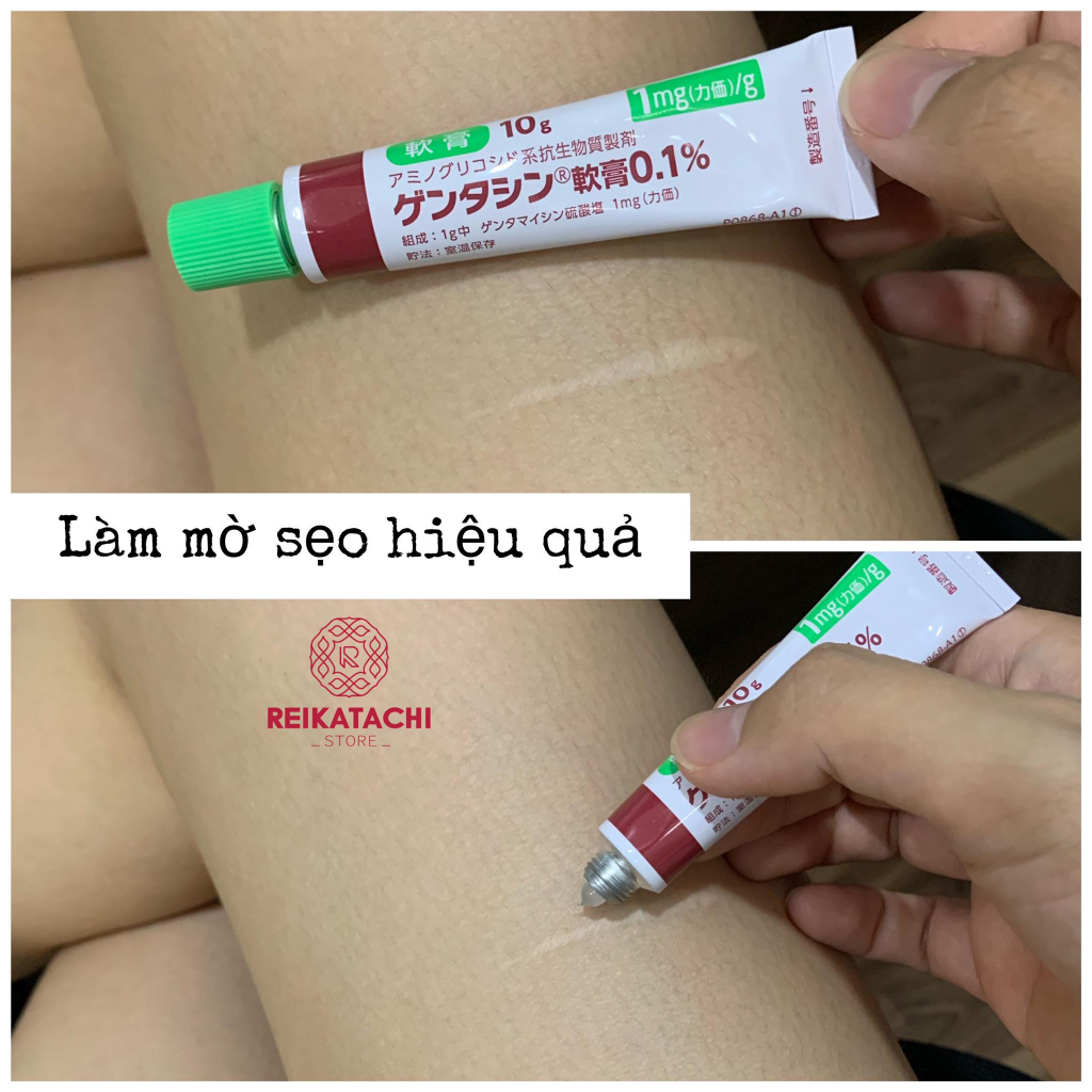 Kem Mờ Sẹo Gentacin, Làm Mờ Sẹo Lồi, Sẹo Rỗ, Sẹo Thâm Nhật Bản 10g Chính Hãng