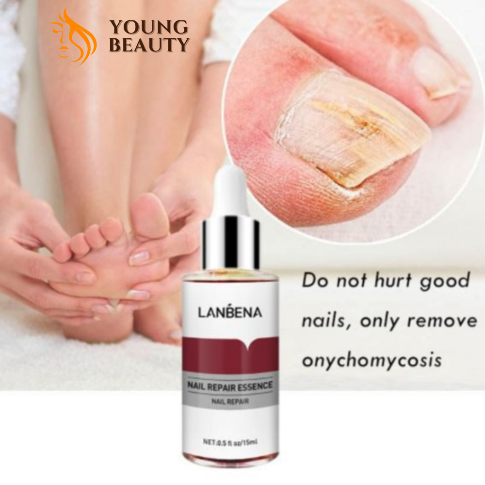 Serum Lanbena phục hồi móng tay chân - Tinh chất chống nấm, nuôi dưỡng tái tạo móng hiệu quả - YOUNG BEAUTY