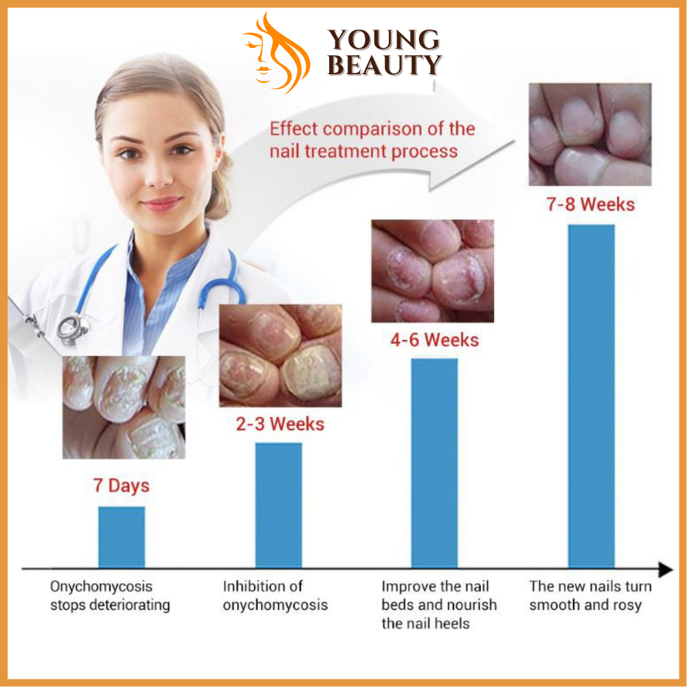 Serum Lanbena phục hồi móng tay chân - Tinh chất chống nấm, nuôi dưỡng tái tạo móng hiệu quả - YOUNG BEAUTY