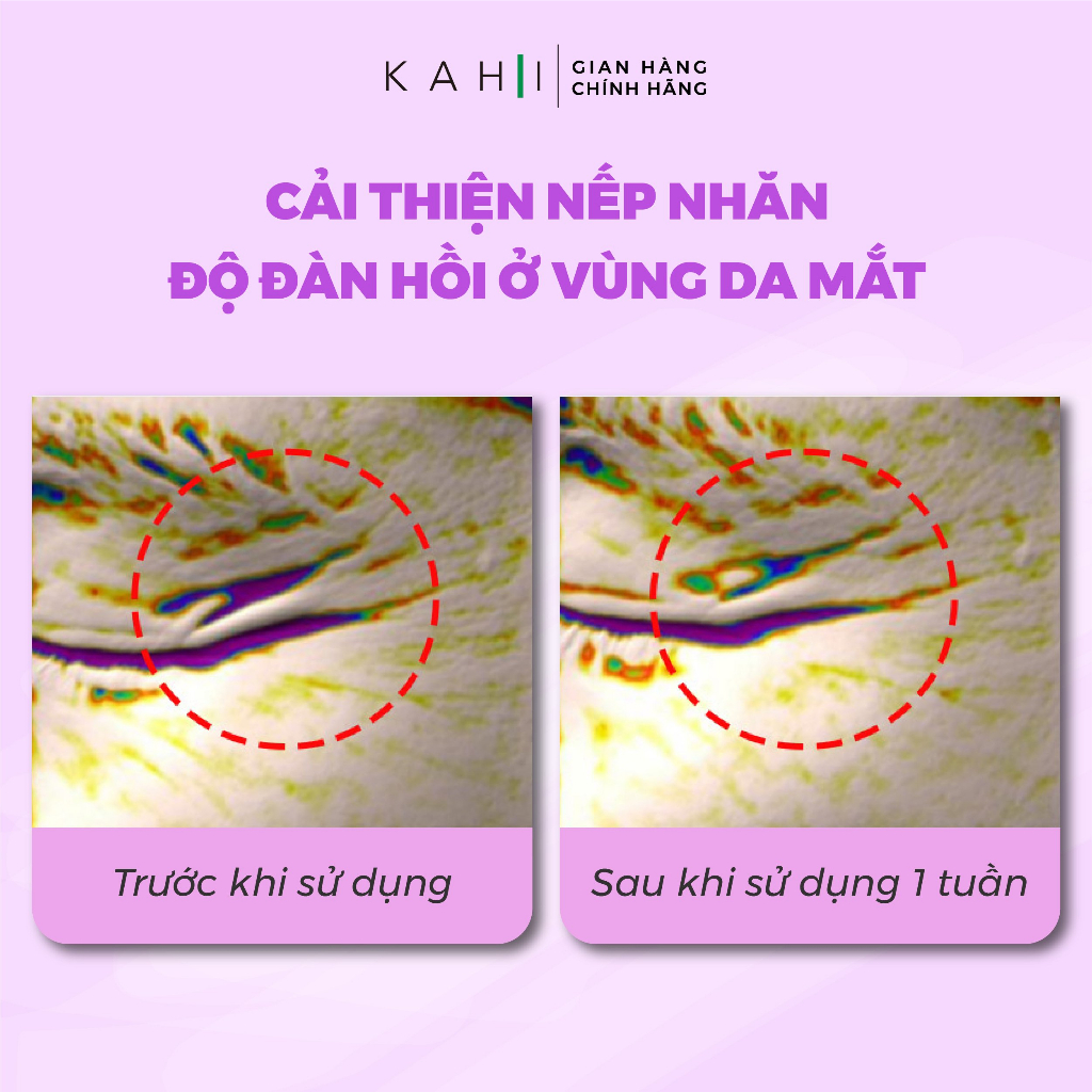 KAHI EYE BALM- Sáp dưỡng cải thiện quầng thâm, tăng cường đàn hồi vùng da mắt