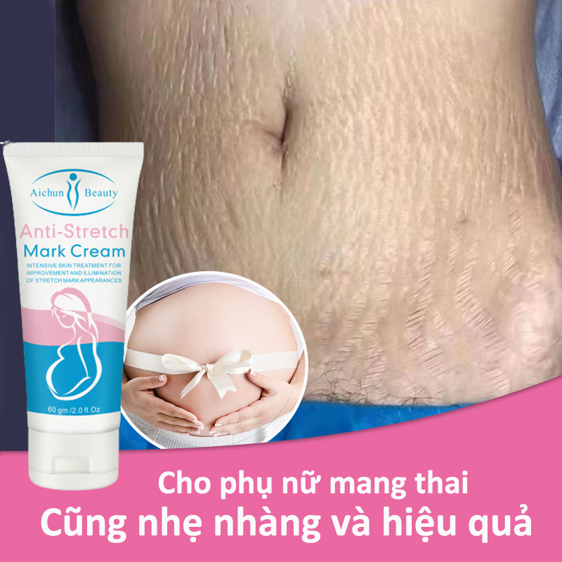 kem rạn da Kem xóa nhăn Kem loại bỏ sẹo 60g làm mờ vết rạn sau sinh làm săn chắc da cho bà bầu làm hết mờ sẹo làm trắng