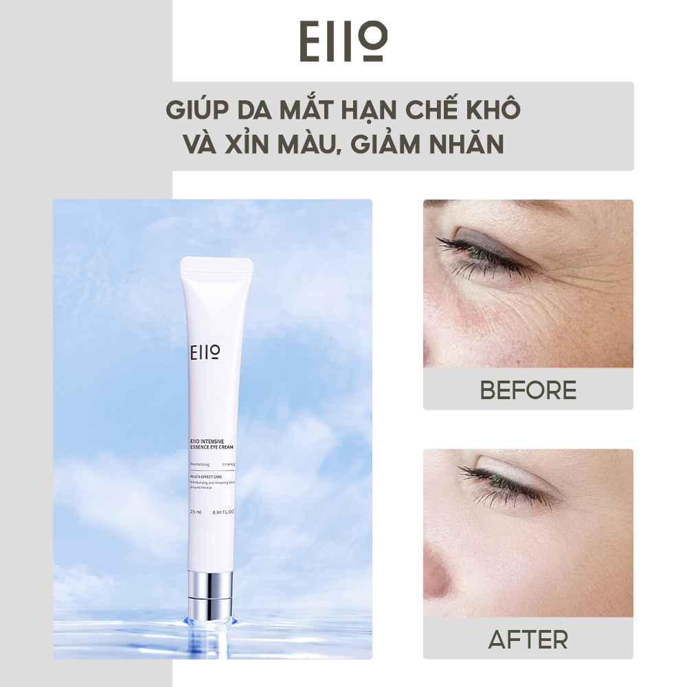 Kem Dưỡng Giảm Quầng Thâm Mắt EIIO Intensive Essence Eye Cream 25ml