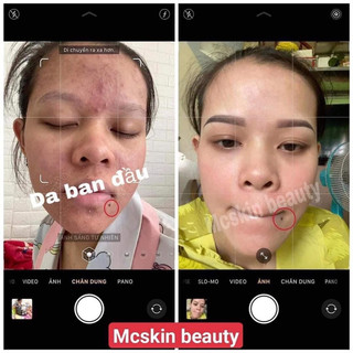 [ GIá Sỉ ] Tái Tạo Hồng Sâm MCSKIN.