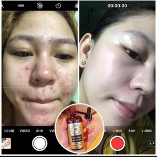 [ GIá Sỉ ] Tái Tạo Hồng Sâm MCSKIN.