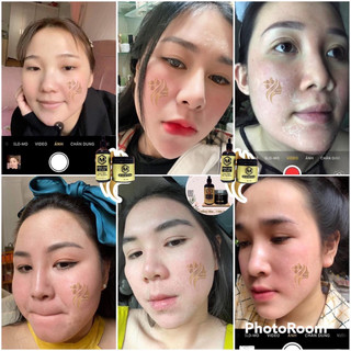 [ GIá Sỉ ] Tái Tạo Hồng Sâm MCSKIN.