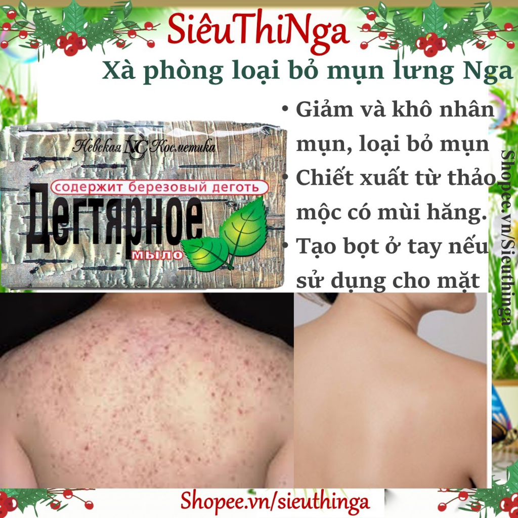 Xà Bông ngừa lụn lưng Neva Nga_Ngăn Ngừa Mụn Chiết Xuất Than Hoạt Tính