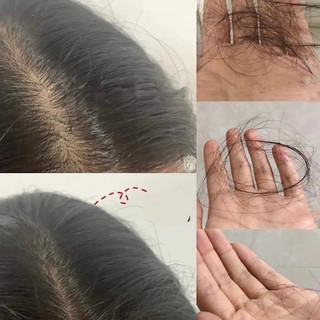 Tinh Chất Mọc Tóc Sato Nhật Bản 30ml