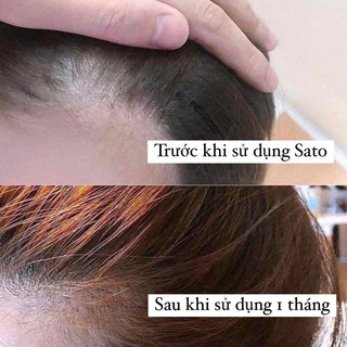 Tinh Chất Mọc Tóc Sato Nhật Bản 30ml