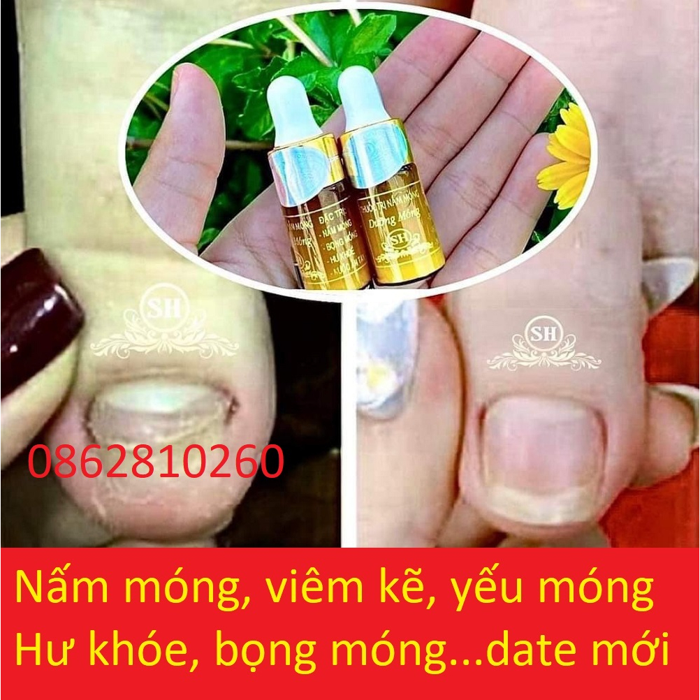 Serum SH đánh bay nấm móng, hư khoé, bọng móng, nước ăn tay chân viem móng