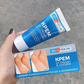 Kem nứt gót chân Nga