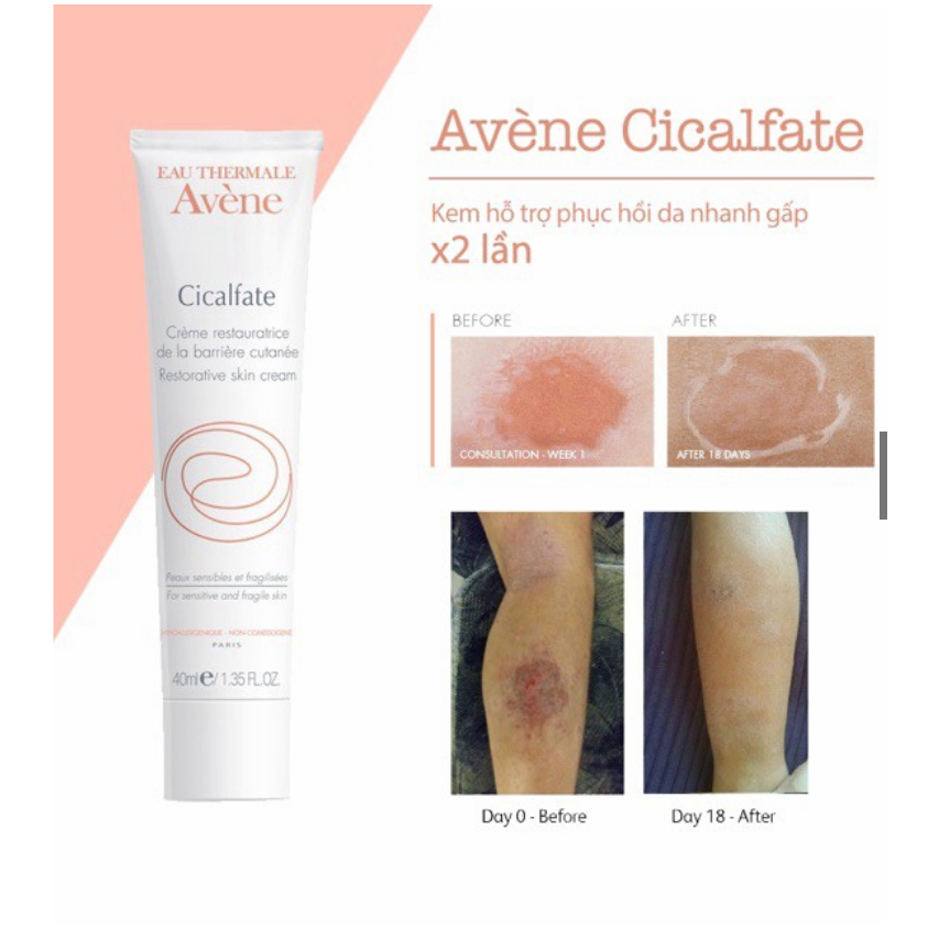 Kem phục hồi Avene Cicalfate, làm lành sẹo và cấp ẩm cho da Avene Cicalfate Restorative Skin Cream 4