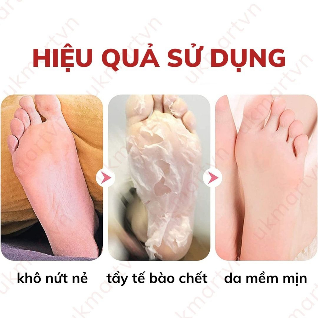 Túi Ủ Tẩy Tế Bào Chết Chân PERORIN Nhật Bản Cho Da Chân Căng Bóng Mịn