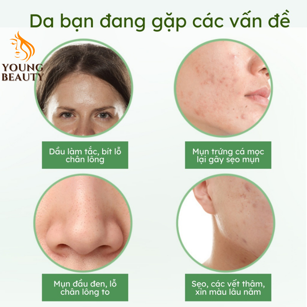 Kem chấm mụn ZHX - Kem giảm mụn ZHX, ngừa mụn mủ, mụn đầu đen, mụn viêm, giảm thâm mụn 20ml - YOUNG BEAUTY