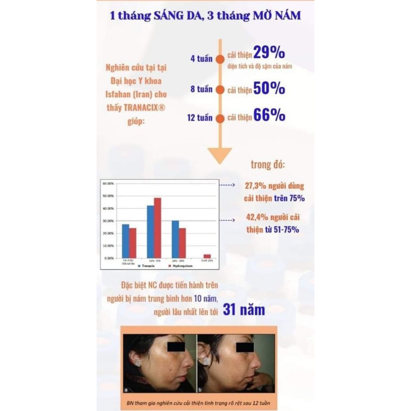 TRANACIX CREAM 30g kem hỗ trợ giảm nám, tàn nhang