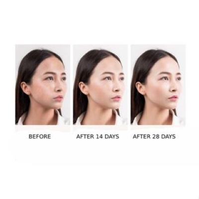 Sữa rửa mặt trắng da, loại bỏ tàn nhang, dưỡng ẩm, trẻ hóa làn da 350g