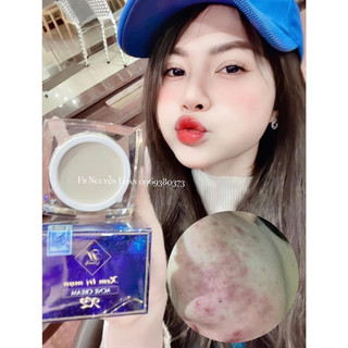 KEM MỤN X2 THBEAUTY (combo 2 kem)