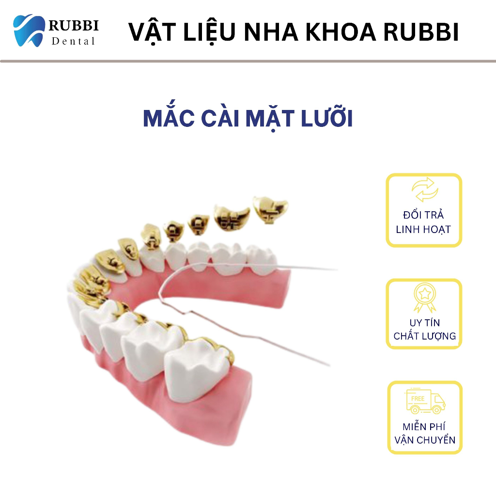 Mắc cài mặt lưỡi