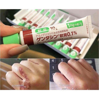 Kem mờ sẹo Gentacin Nhật Bản 10g