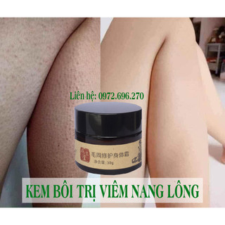 [100% Hàng nội địa chính hãng ] Kem bôi viêm nang lông - viêm lỗ chân lông