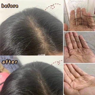 Tinh chất kích thích mọc tóc Sato - Nhật Bản 30ml