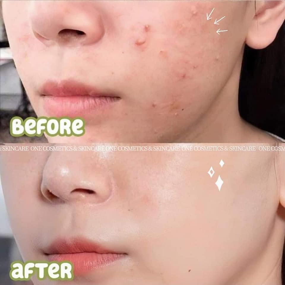 Serum S.V.R Seabiaclear 4% Niacinamide và 14% PHA Tinh Chất Dưỡng 30ml