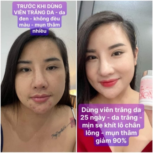 Viên ngậm Glutathione 2500MG lọ 60 viên, Trắng da, chống nắng, Siêu hủy nám, cân bằng nội tiết, samcosetics2017 | BigBuy360 - bigbuy360.vn