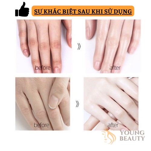 Kem dưỡng da tay YINBA chứa Hyaluronic Acid - Kem dưỡng ẩm giúp làm trắng da, mờ thâm - YOUNG BEAUTY