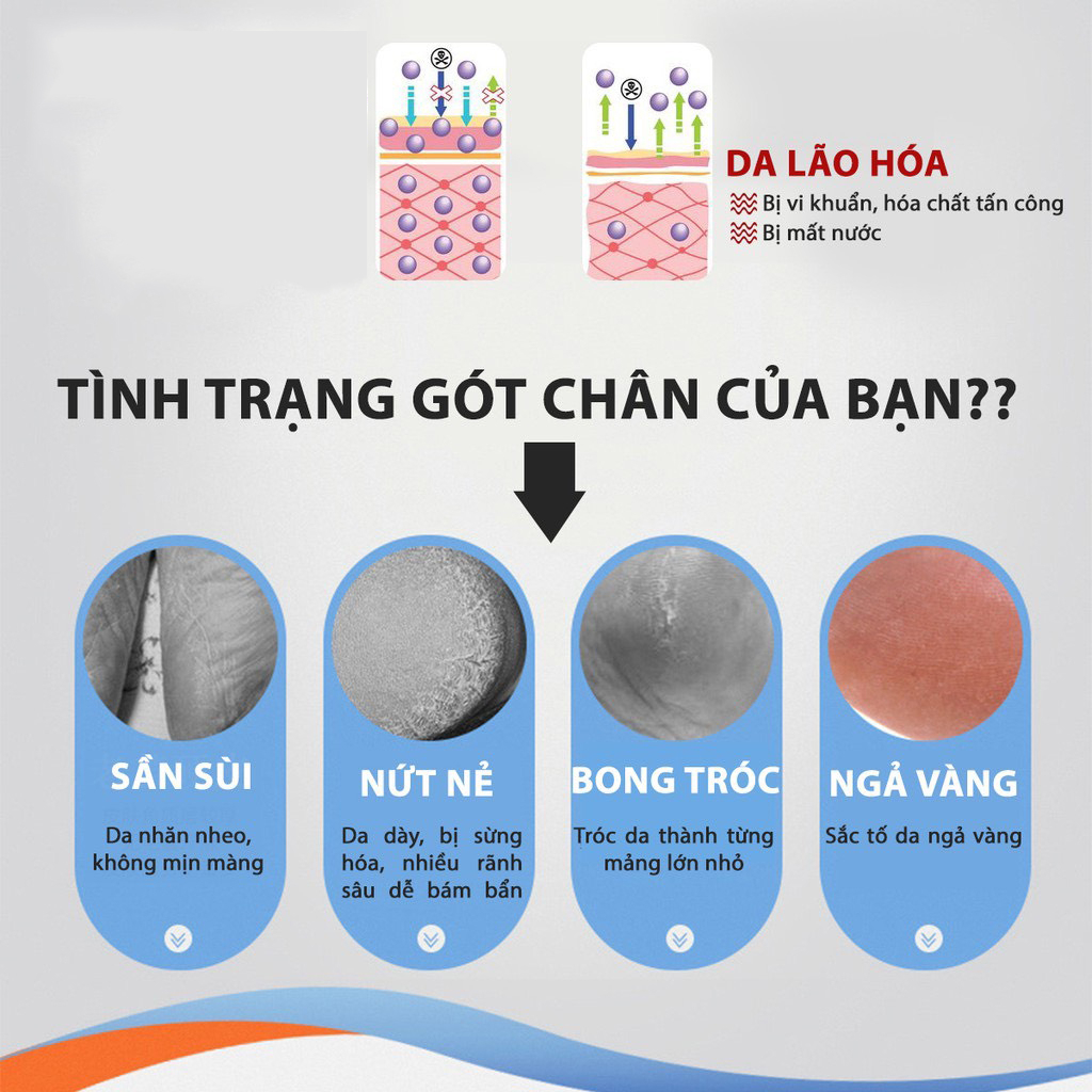 Set 2 Lót Gót Da Silicon Giày Nữ Bị Rộng, Lót Gót Chân Silicon Chống Đau Gót Chân, Lót Giày Silicon Chống Đau Gót Chân