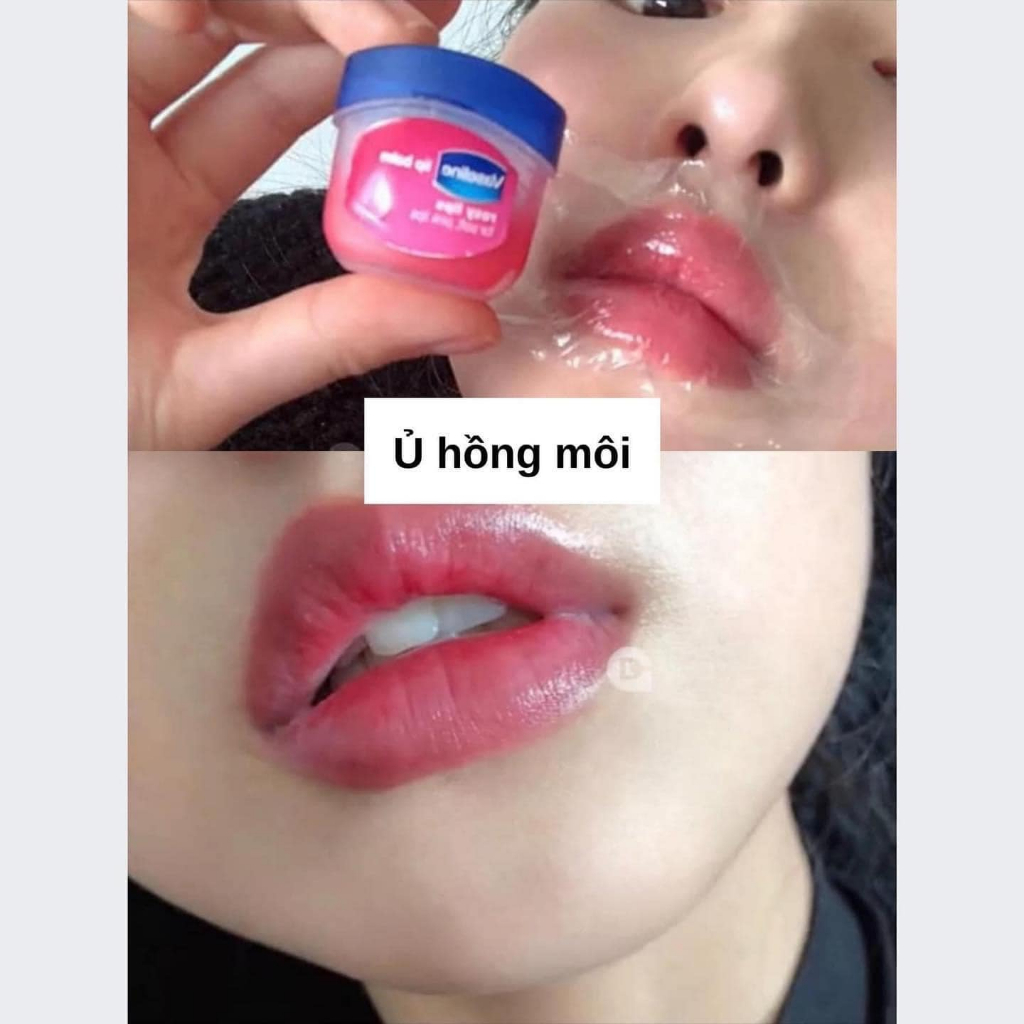 Sáp Dưỡng Môi Mềm Mọng Vaseline Lip Therapy 7g