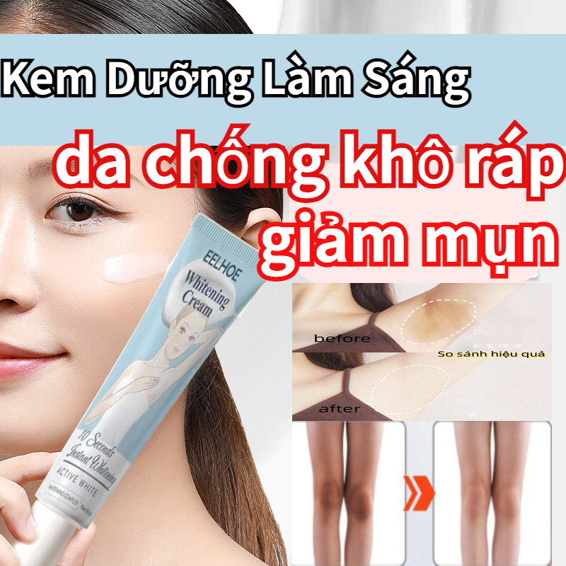 Kem Dưỡng Làm Sáng Trắng Da dành cho mọi loại da giảm mụn，cho nách Kem tẩy tế bào chết làm da sáng đều màu dưỡng ẩm da
