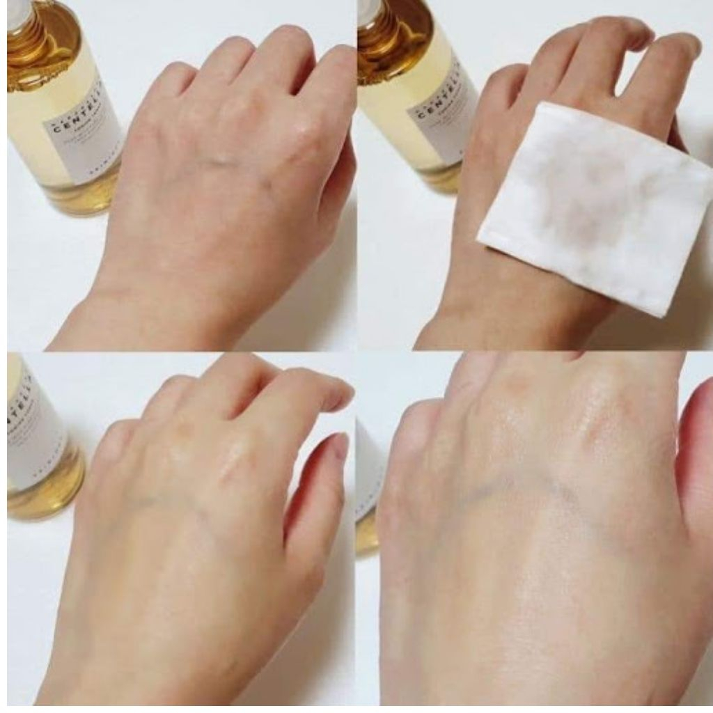 Nước Hoa Hồng Rau Má Skin1004 Madagascar Centella Toning Toner Giúp Cân Bằng, Dưỡng Trắng Da 210ML