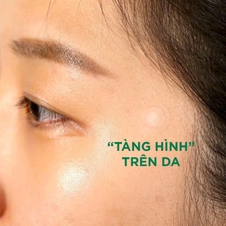 Miếng dán mụn Somebymi giảm sưng viêm