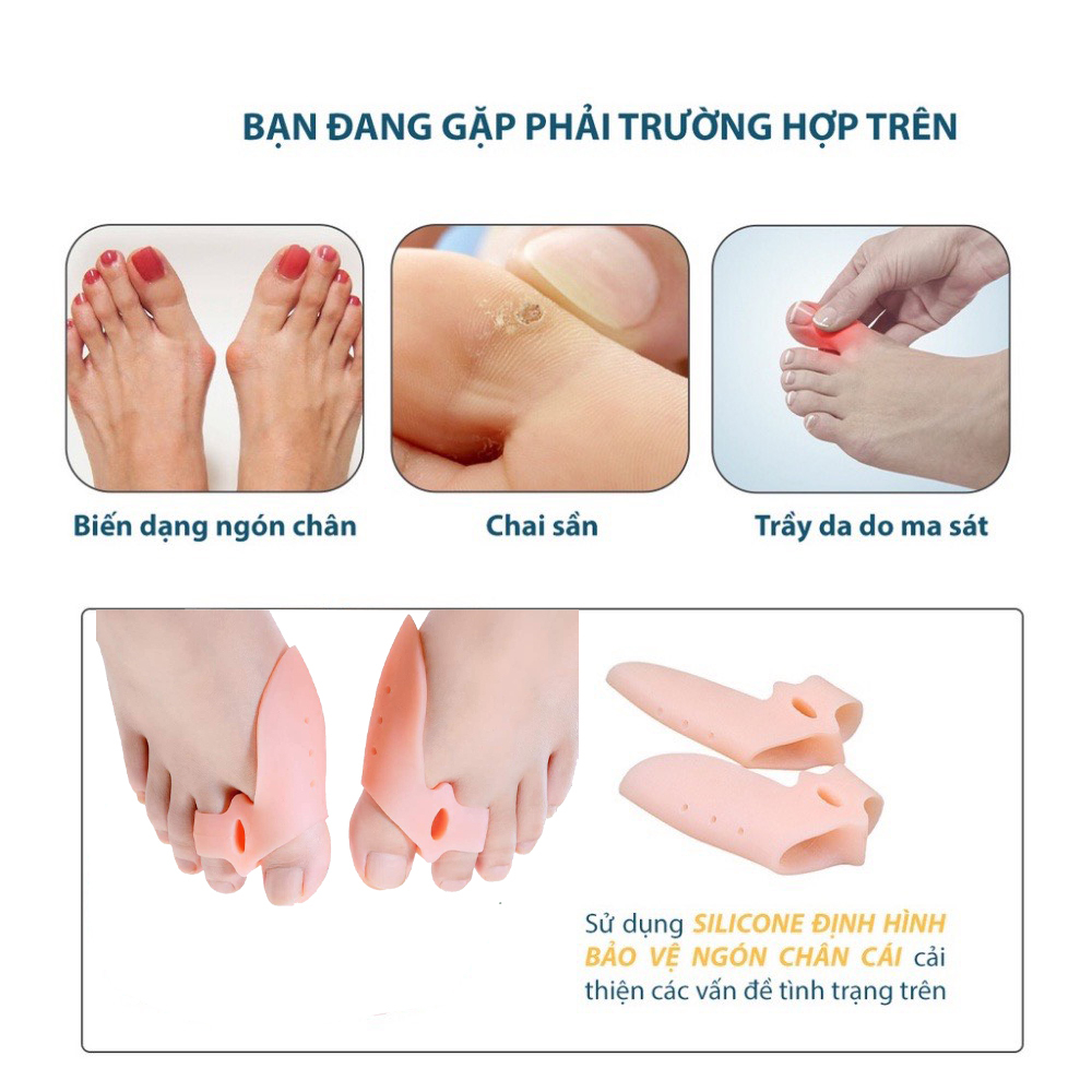 Dụng Cụ Tách Ngón Chân Cái Bằng Silicon, Tách Ngón Chân Cái Silicon