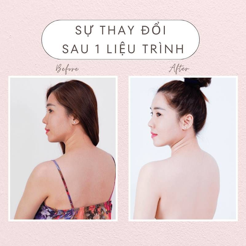 Viên uống hỗ trợ trắng da glutathione 16000mg, Collagen +C mờ nám giảm tàn nhang chống lão hoá da | BigBuy360 - bigbuy360.vn